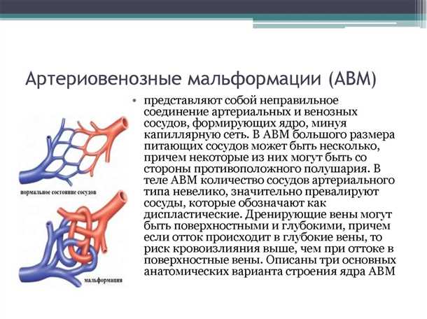 Современные методы лечения и диагностики аномалий сосудов головного мозга