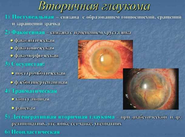 2. Правильное питание