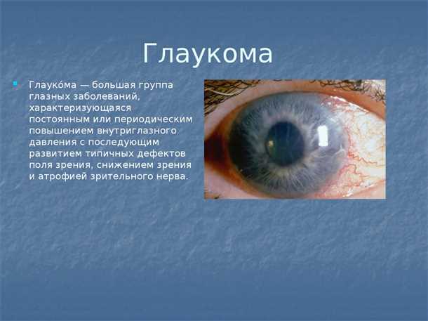 6. Правильное использование контактных линз