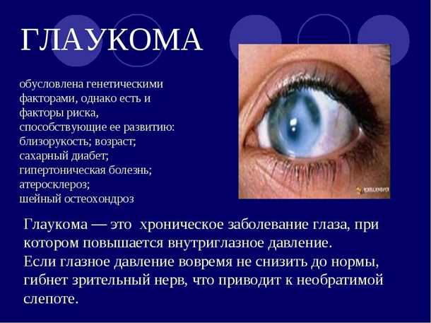 Другие типы глазных болезней