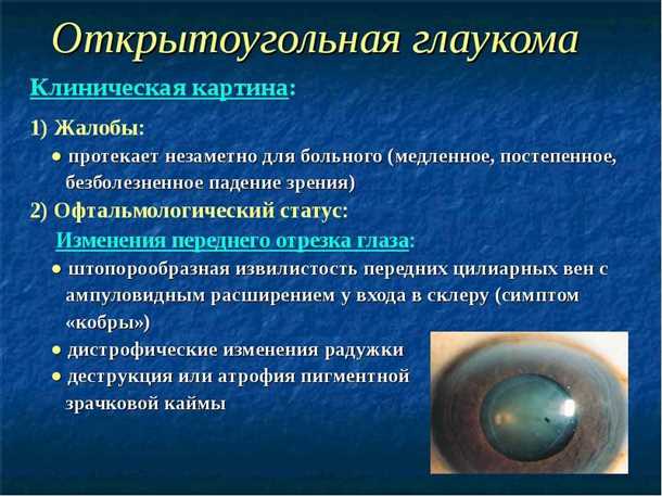 Вторичная глаукома, причины, профилактика, лечение. Все о глазных болезнях.