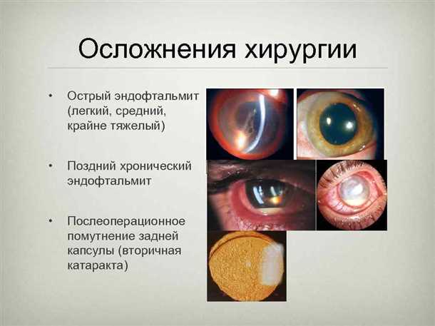  Посещайте плановые приемы и обсуждайте любые изменения в зрении 
