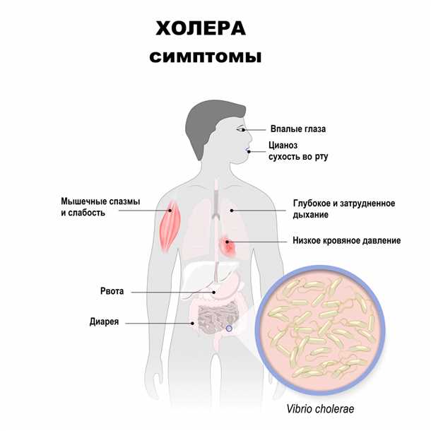 11. Как справиться со стрессом при холере?