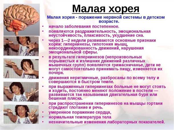 Физическая реабилитация