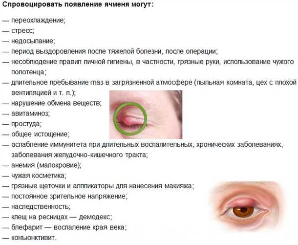 Глазные болезни на портале vseozreni