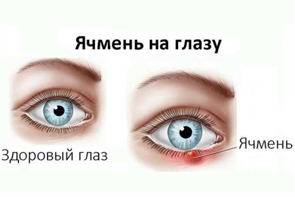 Медикаментозное лечение