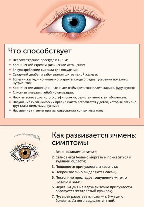 Ячмень на глазу, причины, симптомы, лечение. Все о глазных болезнях на портале vseozreni.