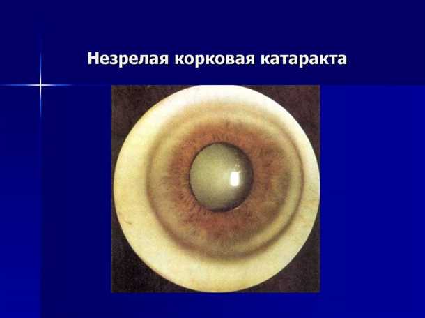 Причины
