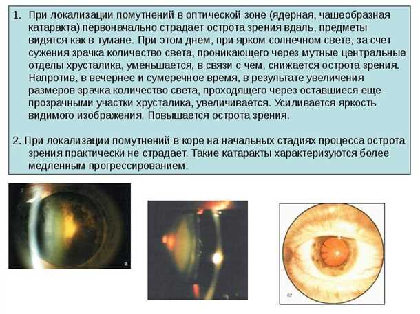 2. Зрительные тесты.