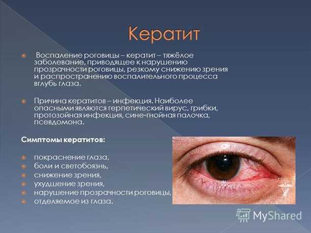 Что такое язва роговицы?