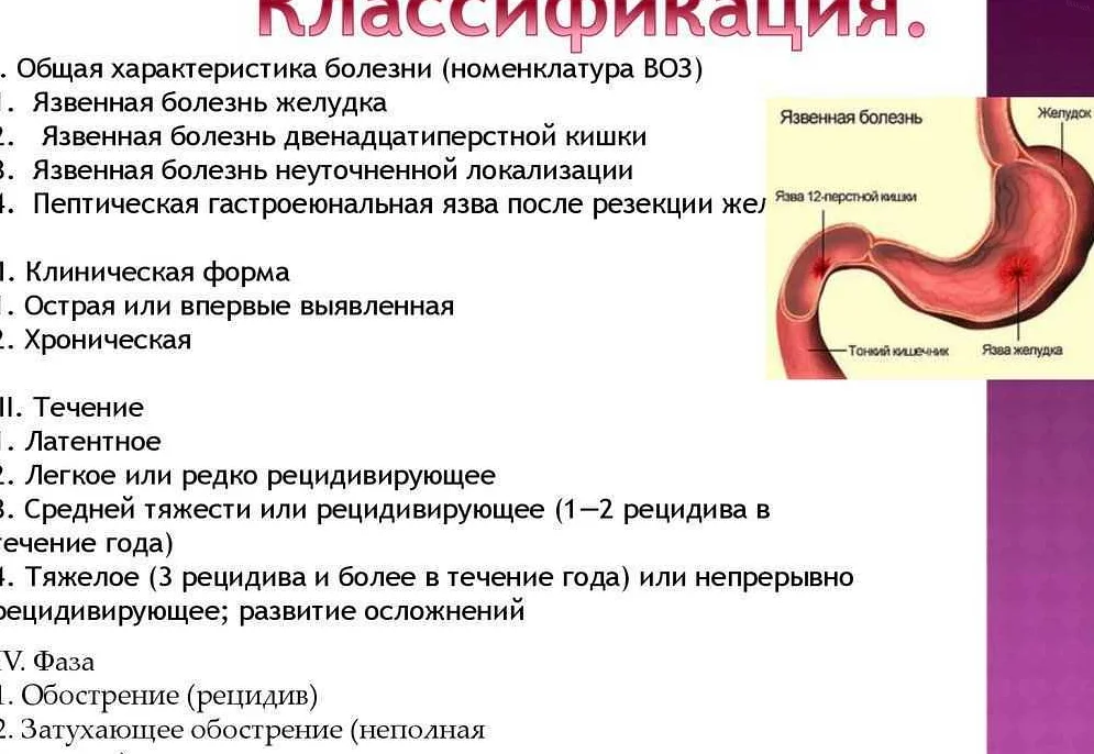 Как предотвратить обострение язвы желудка?