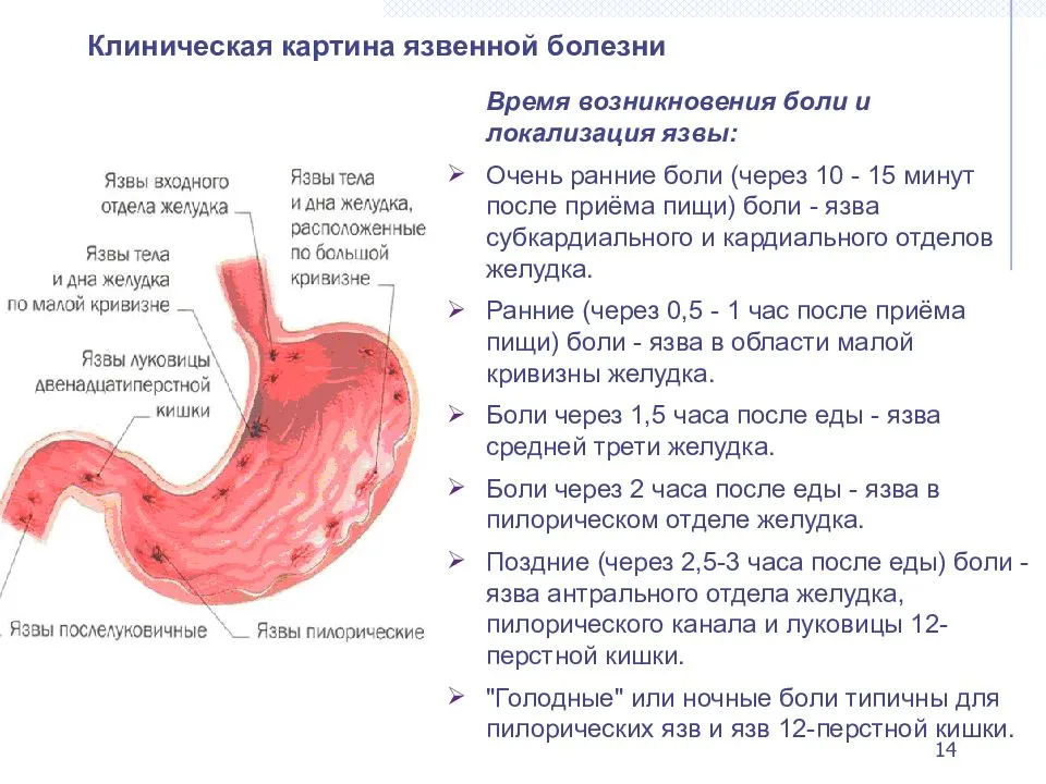 Антациды