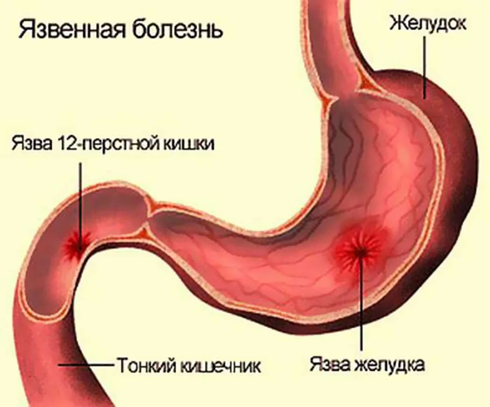 Соблюдайте режим сна