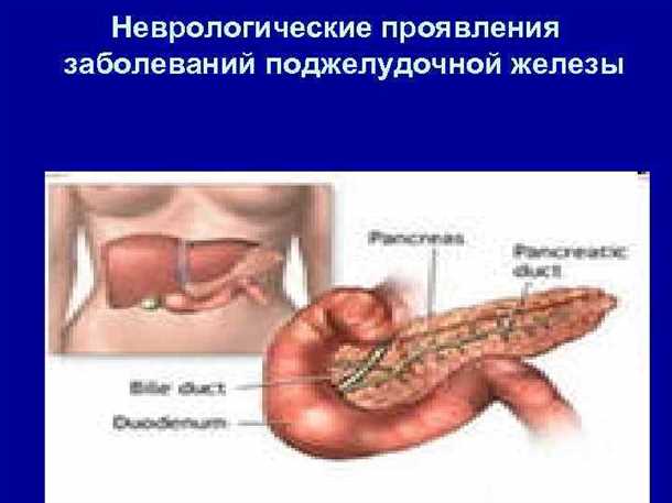 Панкреатит