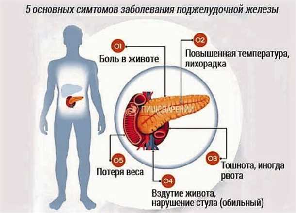 Заболевания поджелудочной железы симптомы и лечение