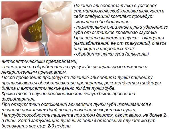 Когда следует обратиться к стоматологу