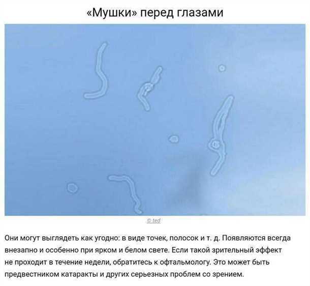 Симптомы желтых пятен перед глазами