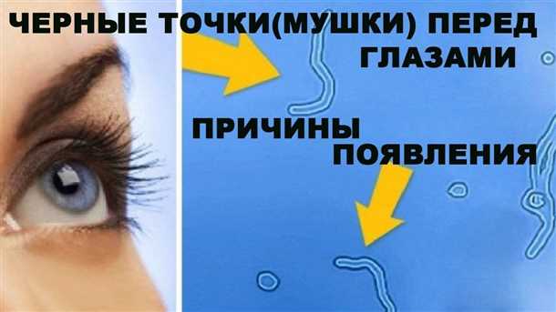 Желтые пятна перед глазами, причины, симптомы, лечение.