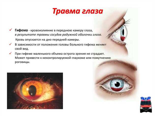 Виды травм глаза