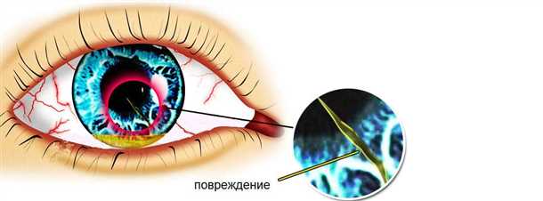 Диагностика травмы глаза