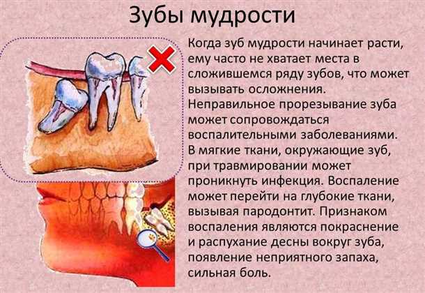Зуб мудрости растет в щеку